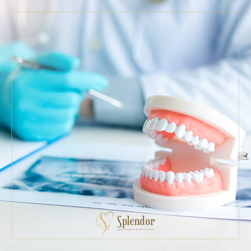 Illustration of teeth showing dental implant structure
