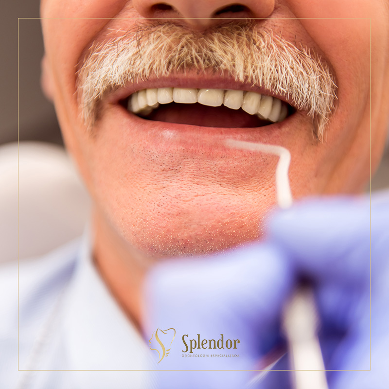 Illustration of teeth showing dental implant structure